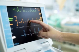 Electrocardiogram (ECG_EKG)