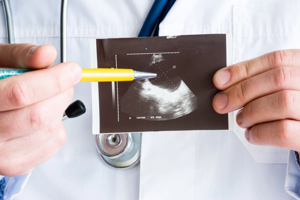 What Is an Echocardiogram