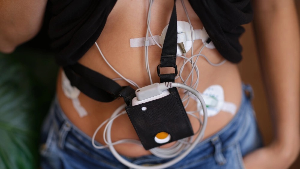 Ambulatory Cardiac Monitoring